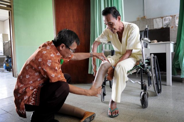 Person affected by leprosy receives a leg prosthese in order to be able to walk